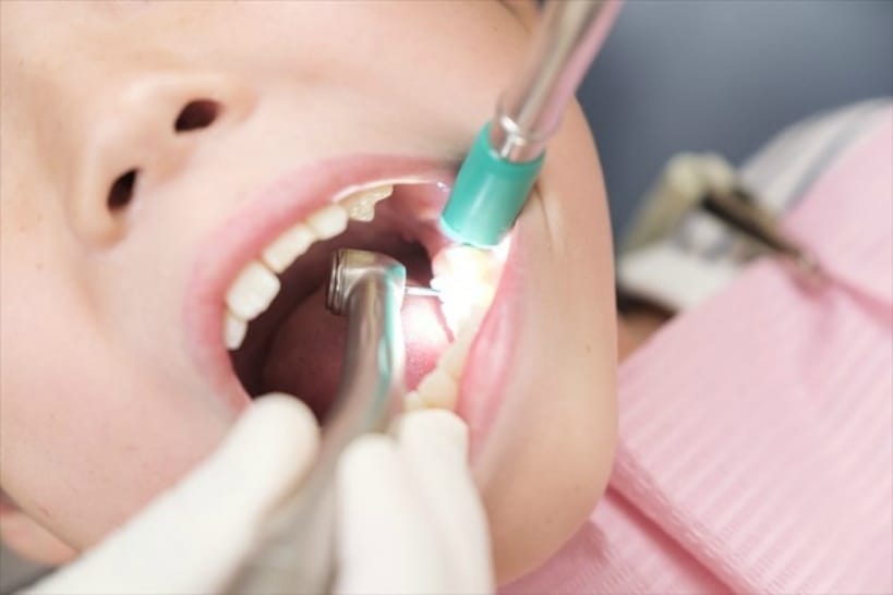 歯科治療中の子供